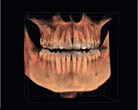 3-D-Röntgen